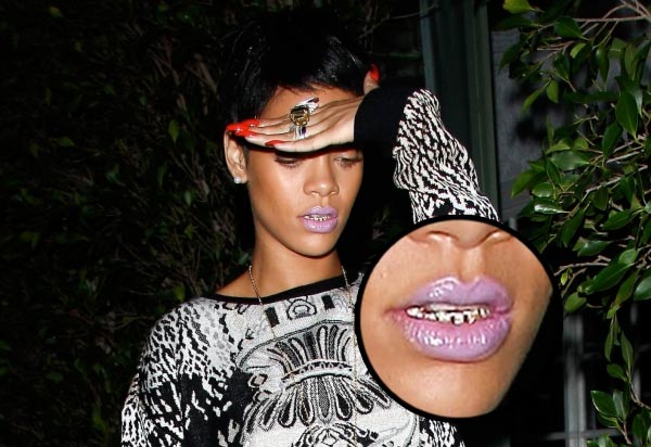 Дуучин Рианна шүдэндээ алтан буу хийлгүүлжээ.